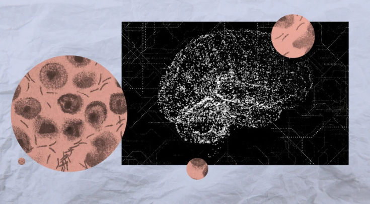 Early Detection of Parkinson’s Disease Using AI (GS Paper 3, Science & Technology)