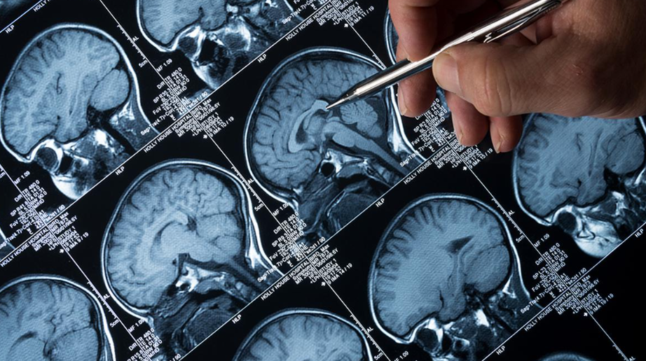 Understanding Magnetic Resonance Imaging (MRI) (GS Paper 3, Science & Tech)