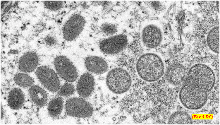 WHO renames monkeypox as mpox, citing racism, discrimination concerns (GS Paper 3, Science and Tech)